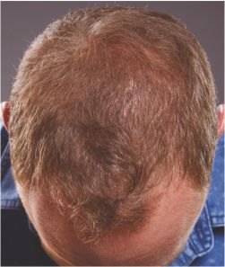 Dan-Whiston_After