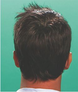 Joel_After