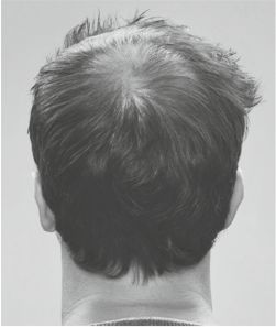 Joel_Before