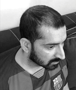 MOHIT Before
